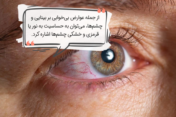 عوارض بی خوابی بر بینایی و چشم
