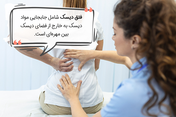 فتق دیسک به چه معناست