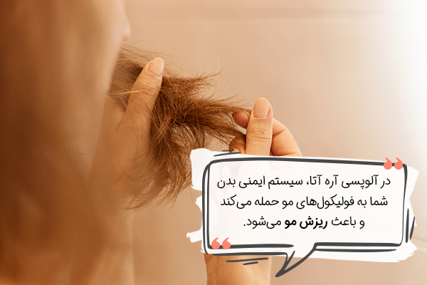 استرس و ریزش مو