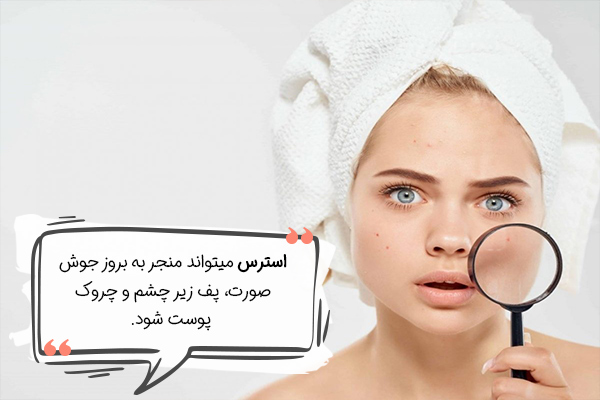 پوست مستقیما تحت تاثیر استرس محیطی است.