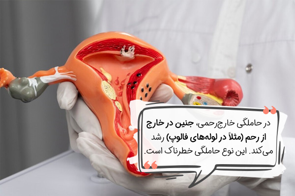 حاملگی خارج رحمی به چه معناست؟