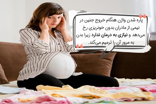 ترس از زایمان به دلیل پاره شدن واژن