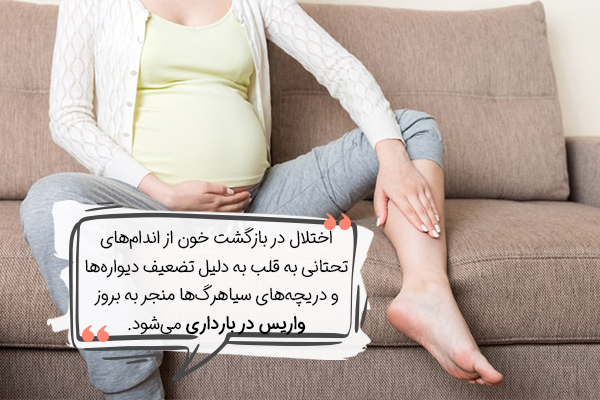 واریس در بارداری چیست؟