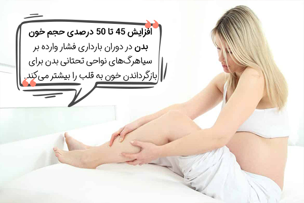 علت واریس در دوران بارداری چیست؟