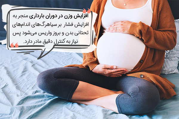 نقش افزایش وزن در واریس در بارداری