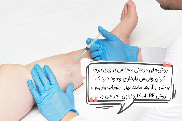 واریس دوران بارداری را چگونه درمان کنیم؟