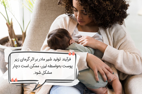 لیزر موهای زائد در دوران شیردهی و کاهش شیر مادر