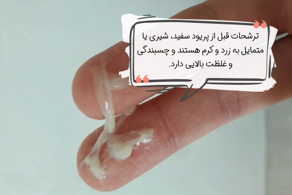 شکل ترشحات قبل از پریودی